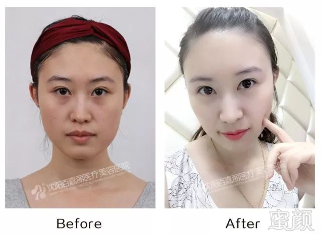 https://img.miyanlife.com/mnt/timg/181021/1150503418-8.jpg