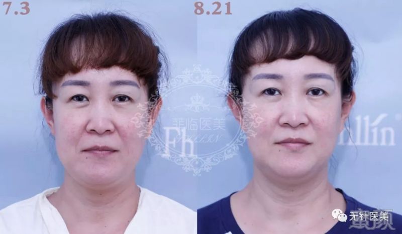 https://img.miyanlife.com/mnt/timg/181021/1201426261-8.jpg