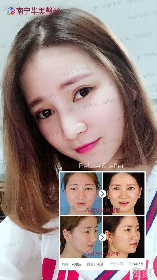 https://img.miyanlife.com/mnt/timg/181021/1225555352-5.jpg
