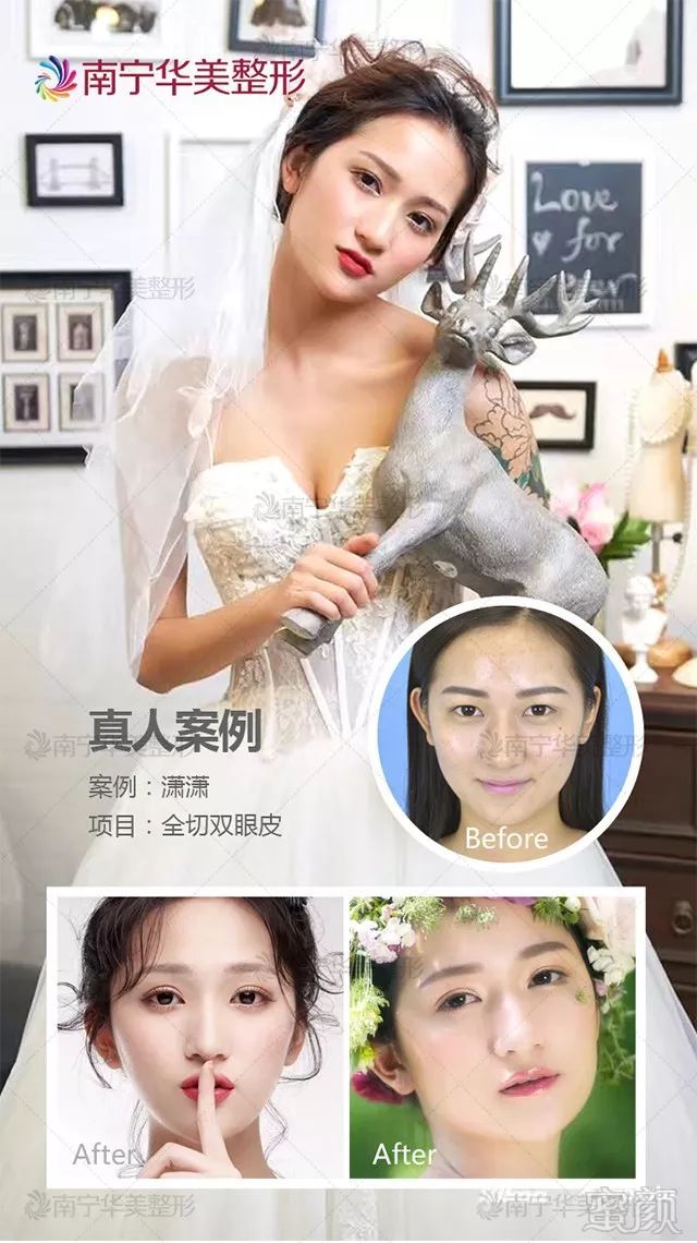 https://img.miyanlife.com/mnt/timg/181021/1225555647-2.jpg