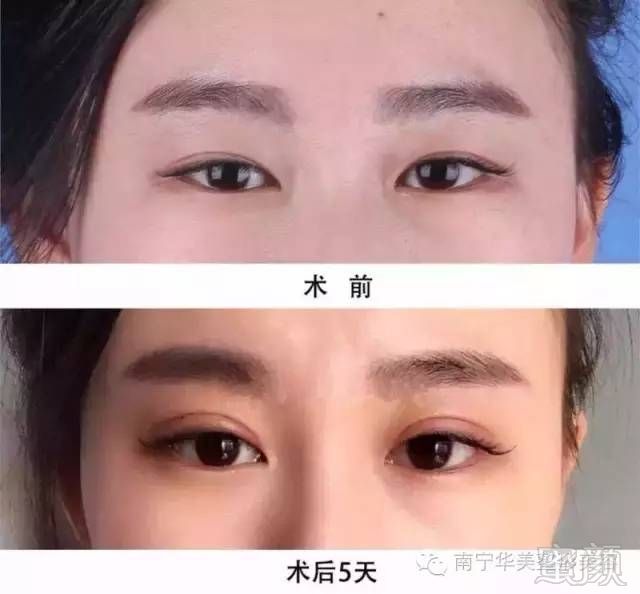 https://img.miyanlife.com/mnt/timg/181021/1225563O9-11.jpg