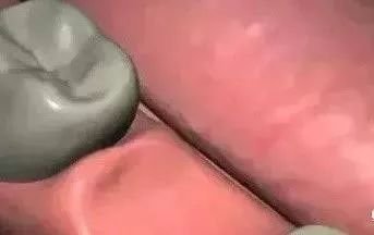 https://img.miyanlife.com/mnt/timg/181021/123U52c6-0.jpg
