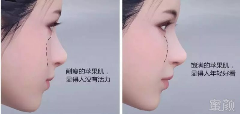 https://img.miyanlife.com/mnt/timg/181021/124GU0H-6.jpg