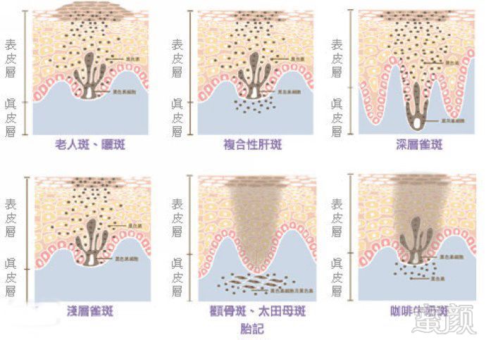 案例图片