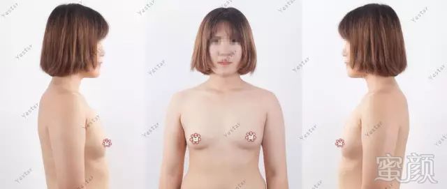 https://img.miyanlife.com/mnt/timg/181022/12434014C-2.jpg