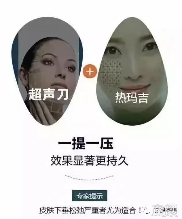 https://img.miyanlife.com/mnt/timg/181022/1324525N6-4.jpg