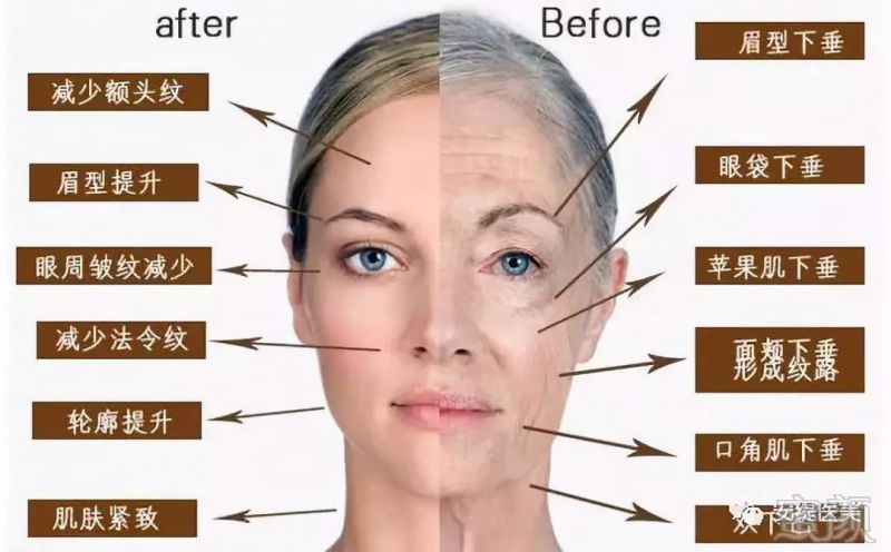 https://img.miyanlife.com/mnt/timg/181022/132452G96-5.jpg