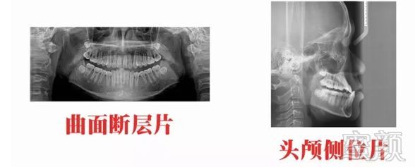 https://img.miyanlife.com/mnt/timg/181022/132540L18-6.jpg