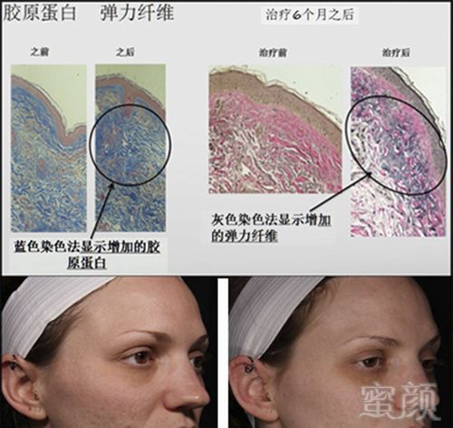 https://img.miyanlife.com/mnt/timg/181022/13291QK3-10.jpg