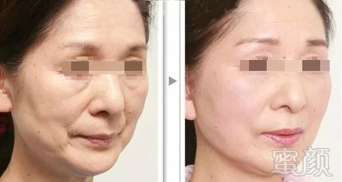 https://img.miyanlife.com/mnt/timg/181022/13291V962-14.jpg