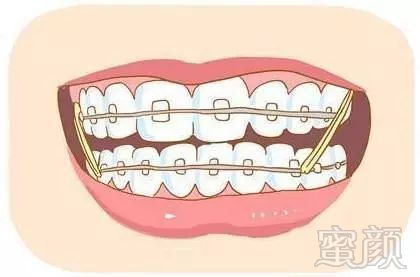 https://img.miyanlife.com/mnt/timg/181023/131950HO-6.jpg
