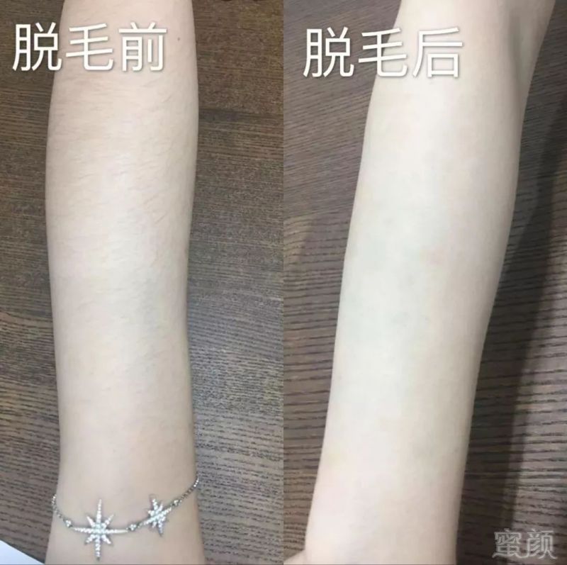 https://img.miyanlife.com/mnt/timg/181024/11055Jc1-6.jpg