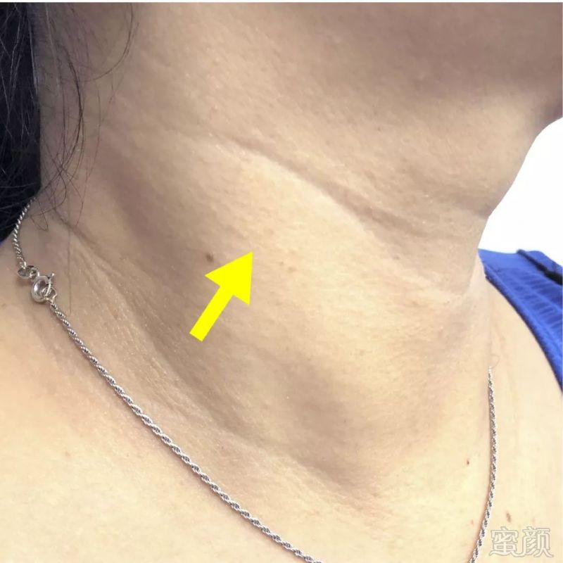 https://img.miyanlife.com/mnt/timg/181024/1130511b1-5.jpg