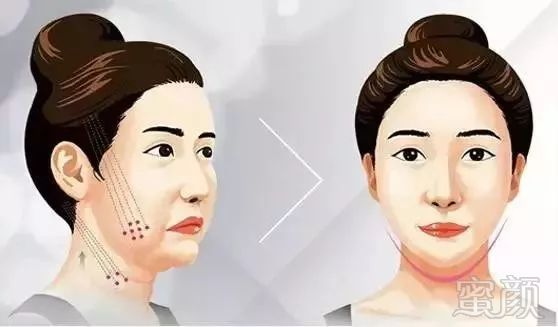 https://img.miyanlife.com/mnt/timg/181024/113QI302-11.jpg