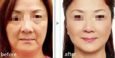 https://img.miyanlife.com/mnt/timg/181024/113QLJ2-10.jpg