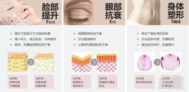 https://img.miyanlife.com/mnt/timg/181024/113QMP2-9.jpg