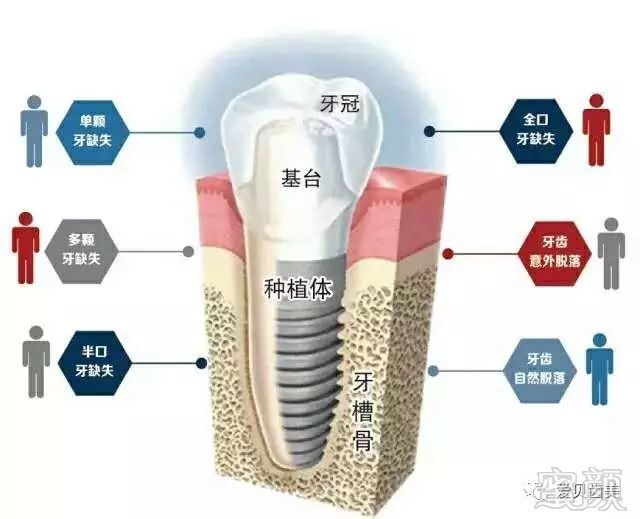 https://img.miyanlife.com/mnt/timg/181024/1150392H2-0.jpg