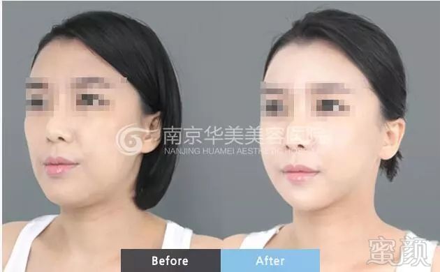 https://img.miyanlife.com/mnt/timg/181024/1153062N9-2.jpg
