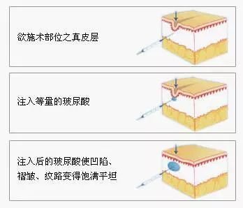 https://img.miyanlife.com/mnt/timg/181024/1153064339-1.jpg