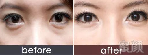 https://img.miyanlife.com/mnt/timg/181024/11535621X-2.jpg