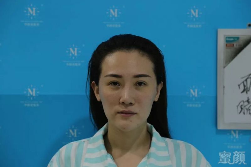 https://img.miyanlife.com/mnt/timg/181024/1154496393-1.jpg