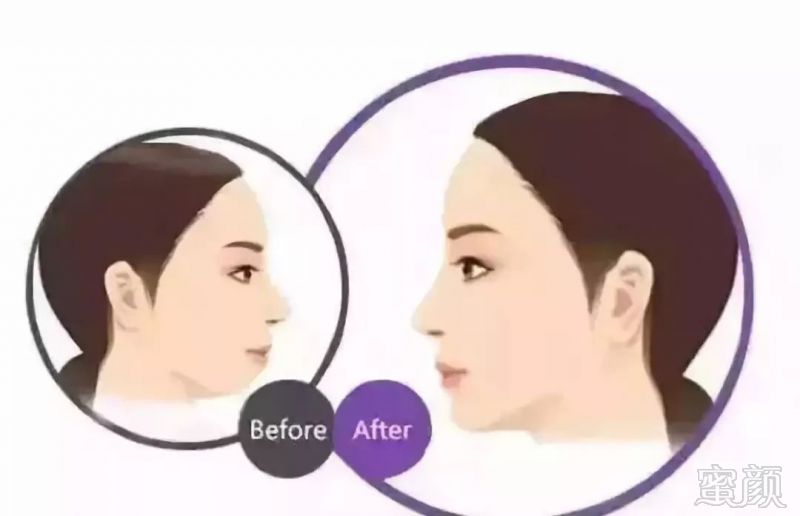 https://img.miyanlife.com/mnt/timg/181024/120033K16-6.jpg