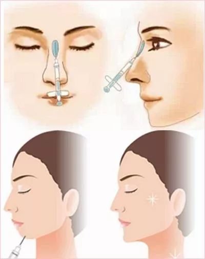 https://img.miyanlife.com/mnt/timg/181024/12003435J-14.jpg