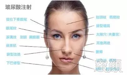 https://img.miyanlife.com/mnt/timg/181024/122I32N8-4.jpg