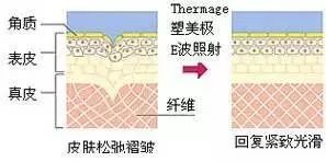 https://img.miyanlife.com/mnt/timg/181025/1136443003-14.jpg
