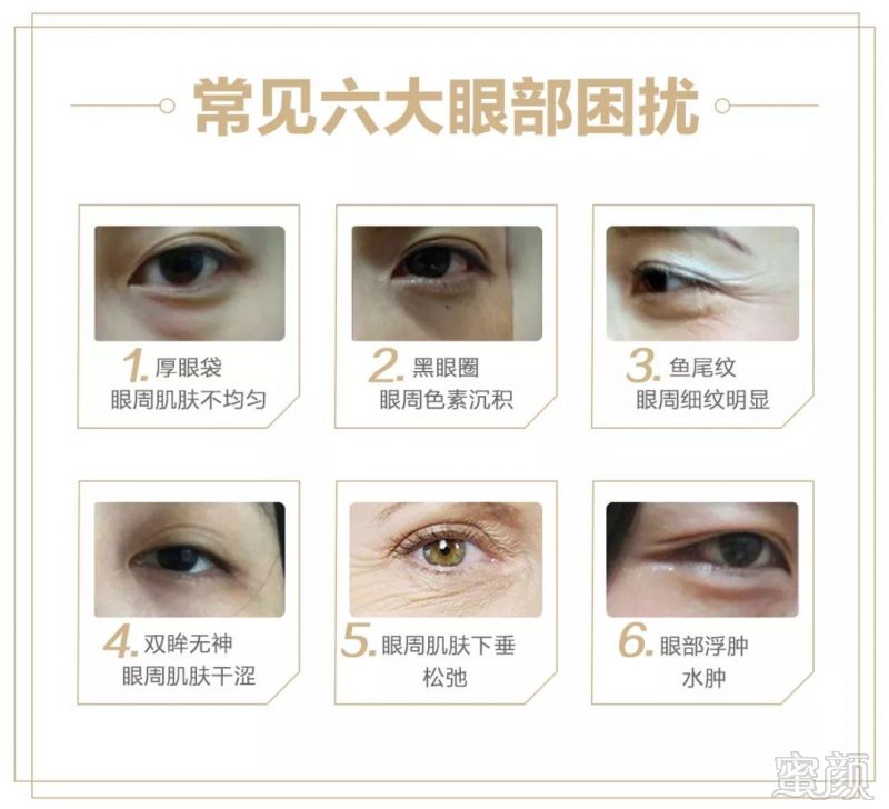 https://img.miyanlife.com/mnt/timg/181025/114230C25-1.jpg