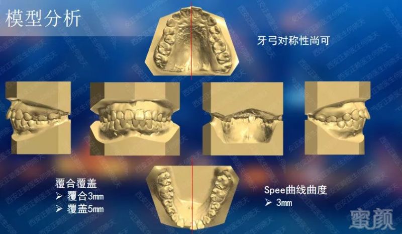 案例图片