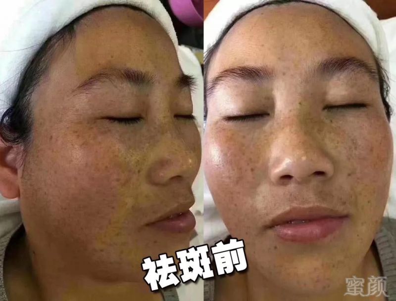 https://img.miyanlife.com/mnt/timg/181025/121F2H61-0.jpg
