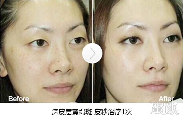 https://img.miyanlife.com/mnt/timg/181025/121F42411-9.jpg