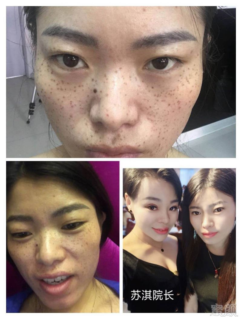https://img.miyanlife.com/mnt/timg/181025/121F435W-7.jpg