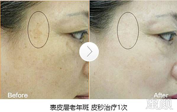 https://img.miyanlife.com/mnt/timg/181025/121F55U5-10.jpg