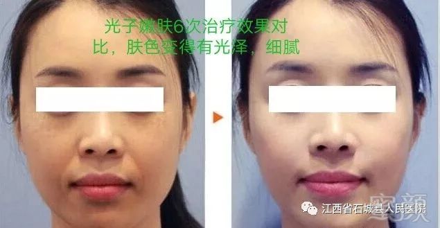 https://img.miyanlife.com/mnt/timg/181025/12200K457-5.jpg