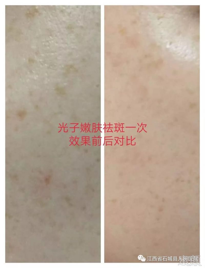 https://img.miyanlife.com/mnt/timg/181025/12200L096-4.jpg