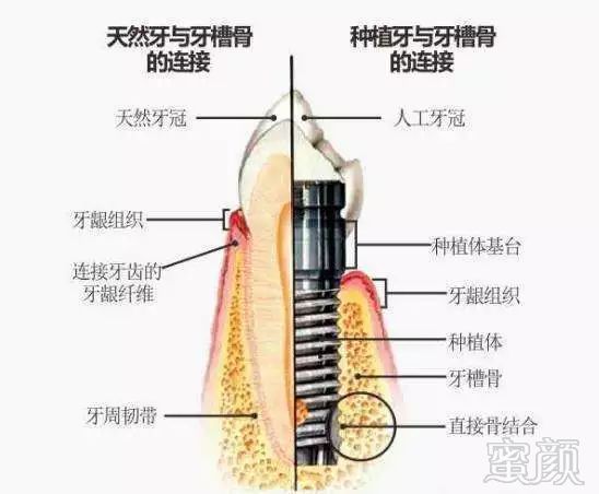 https://img.miyanlife.com/mnt/timg/181025/1224292601-1.jpg
