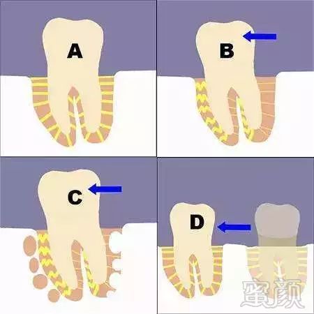 https://img.miyanlife.com/mnt/timg/181025/1224295W5-5.jpg