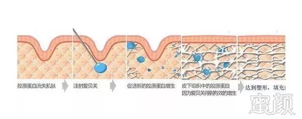 案例图片