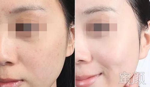 https://img.miyanlife.com/mnt/timg/181025/12411K634-4.jpg