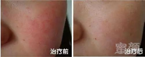 https://img.miyanlife.com/mnt/timg/181025/12411M920-5.jpg