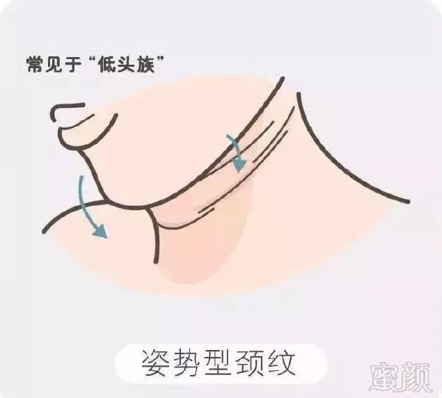 https://img.miyanlife.com/mnt/timg/181025/1246151091-6.jpg