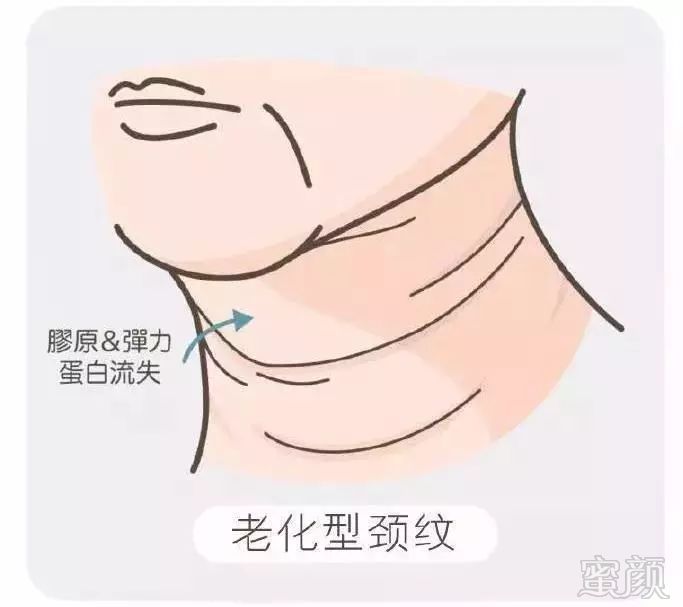 https://img.miyanlife.com/mnt/timg/181025/124615LM-5.jpg