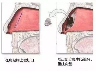 案例图片