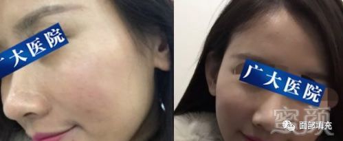 https://img.miyanlife.com/mnt/timg/181025/13015362A-2.jpg
