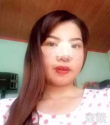 https://img.miyanlife.com/mnt/timg/181026/1130331148-4.jpg