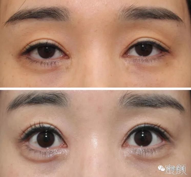 https://img.miyanlife.com/mnt/timg/181026/1204036150-3.jpg