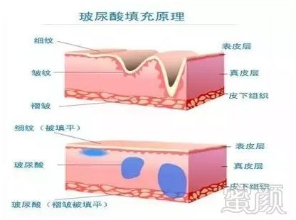 https://img.miyanlife.com/mnt/timg/181026/1210194338-5.jpg