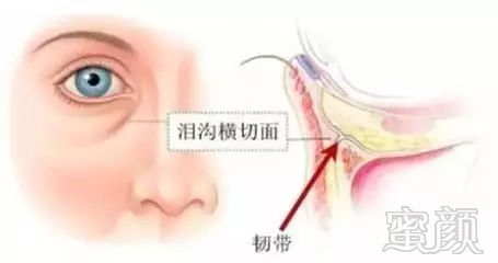 https://img.miyanlife.com/mnt/timg/181026/12101S361-1.jpg